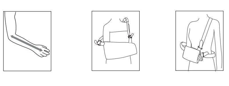 Arm Sling Instructions For Use